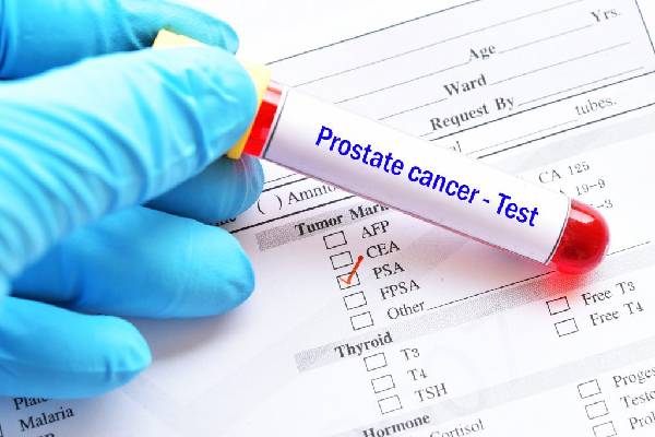 More Information On Prostate Cancer Testing And Diagnosis