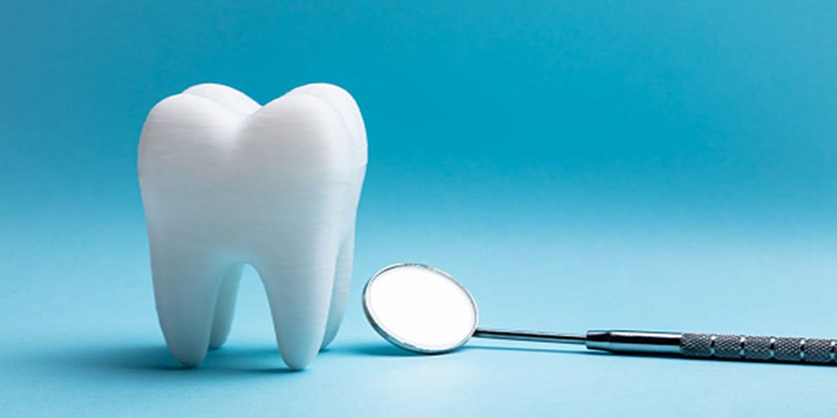 5 things to know before doing dental implants