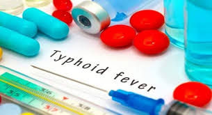 How to Identify and Help Prevent Typhoid Causes