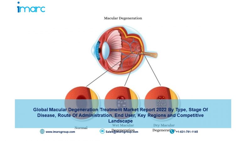 Macular Degeneration Treatment Market 2022 Size, Share, Industry Growth, Trends, Opportunities, Analysis and Forecast by 2027