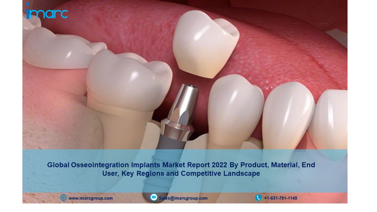 Osseointegration Implants Market Report, Size, Share, Revenue, Competitive Analysis, Demand and Growth by 2027
